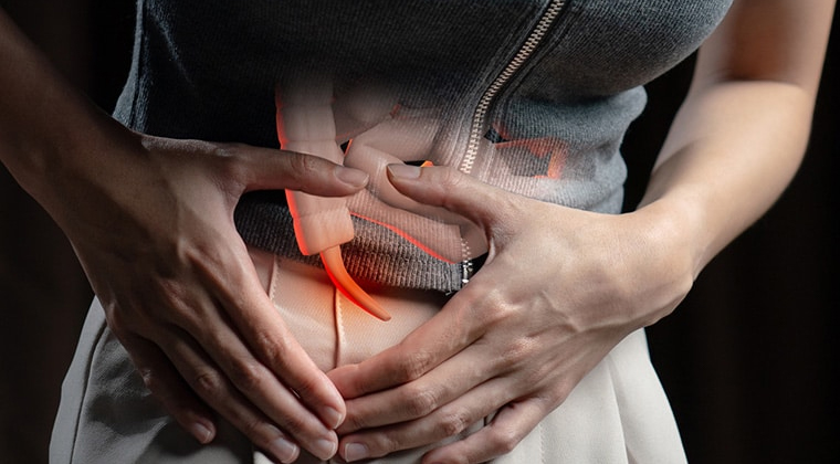 Apendicitis Aguda